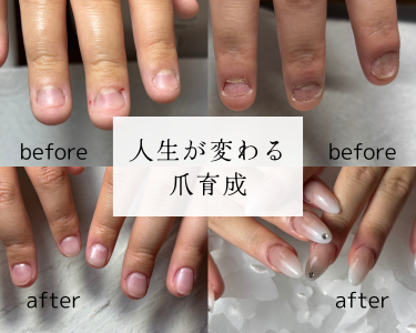 深爪・巻き爪・ハンドケア